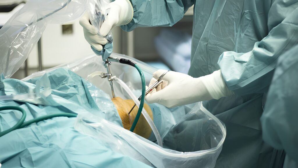 arthroscopy