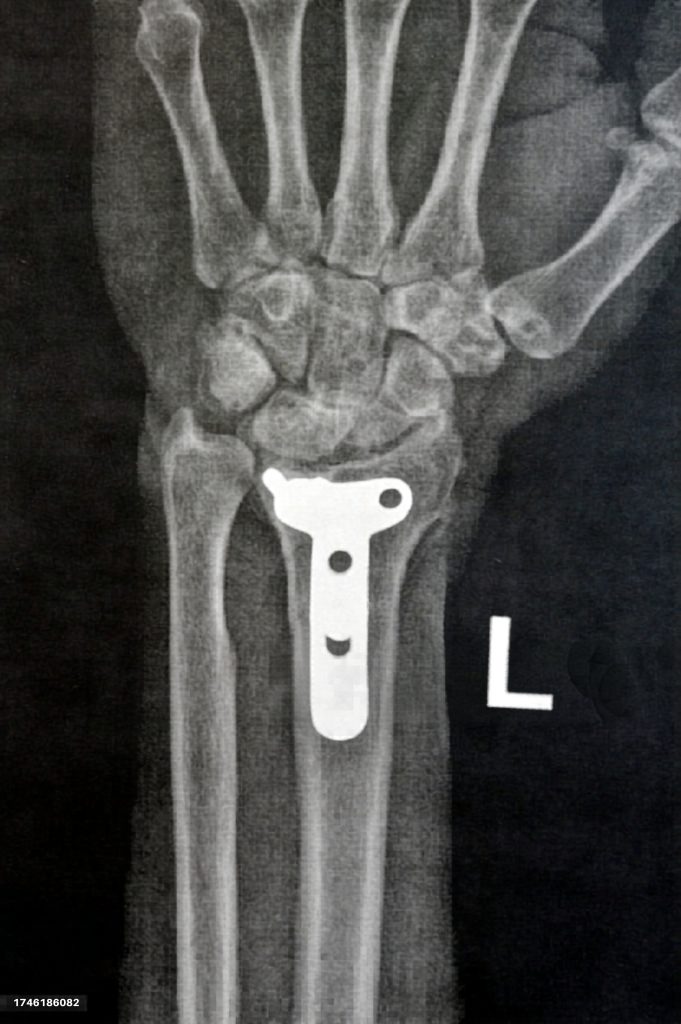 trauma1